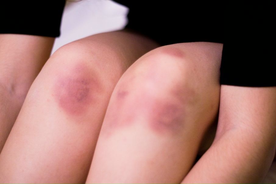 Поля Чудес фото №25