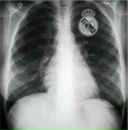 Дімка Дучинський фотография #31 (источник - https://vk.com/id20783960)